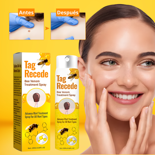 Tag Recede™ – Spray Natural para Eliminar Verrugas y Marcas de la Piel